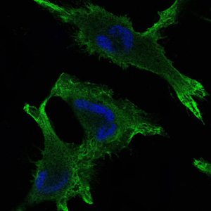 JUP/CTNNG/Junction Plakoglobin Antibody - Immunofluorescence of U251 cells using JUP mouse monoclonal antibody (green). Blue: DRAQ5 fluorescent DNA dye.