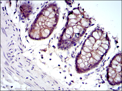 JUP/CTNNG/Junction Plakoglobin Antibody - IHC of paraffin-embedded rectum tissues using JUP mouse monoclonal antibody with DAB staining.