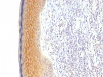 JUP/CTNNG/Junction Plakoglobin Antibody - IHC testing of FFPE human skin with Plakoglobin antibody (clone CTNG/1483). Required HIER: boil tissue sections in 10mM Tris with 1mM EDTA, pH 9, for 10-20 min.