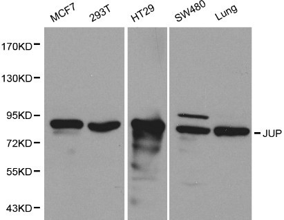 JUP/CTNNG/Junction Plakoglobin Antibody - Western blot of JUP pAb in extracts from MCF7, 293T, HT29, SW480 cells and mouse lung tissue.