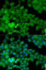 JUP/CTNNG/Junction Plakoglobin Antibody - Immunofluorescence analysis of HeLa cells.
