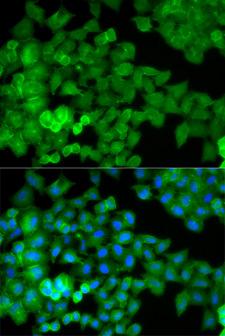 JUP/CTNNG/Junction Plakoglobin Antibody - Immunofluorescence analysis of HeLa cells.