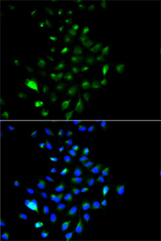 JUP/CTNNG/Junction Plakoglobin Antibody - Immunofluorescence analysis of HeLa cells using JUP antibody. Blue: DAPI for nuclear staining.