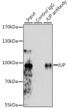 JUP/CTNNG/Junction Plakoglobin Antibody - Immunoprecipitation analysis of 200ug extracts of MCF-7 cells, using 3 ug JUP antibody. Western blot was performed from the immunoprecipitate using JUP antibody at a dilition of 1:1000.