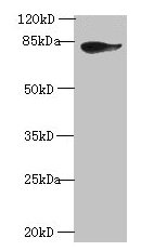 JUP/CTNNG/Junction Plakoglobin Antibody - Western blot All lanes: JUP antibody at 2µg/ml + A431 cells Secondary Goat polyclonal to rabbit IgG at 1/10000 dilution Predicted band size: 82 kDa Observed band size: 82 kDa