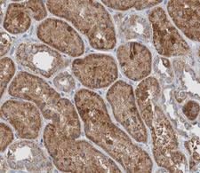 JUP/CTNNG/Junction Plakoglobin Antibody - 1:200 staining human kidney tissue by IHC-P. The tissue was formaldehyde fixed and a heat mediated antigen retrieval step in citrate buffer was performed. The tissue was then blocked and incubated with the antibody for 1.5 hours at 22°C. An HRP conjugated goat anti-rabbit antibody was used as the secondary.
