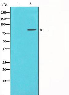 JUP/CTNNG/Junction Plakoglobin Antibody - Western blot analysis on HeLa cell lysates using Catenin-gamma antibody. The lane on the left is treated with the antigen-specific peptide.