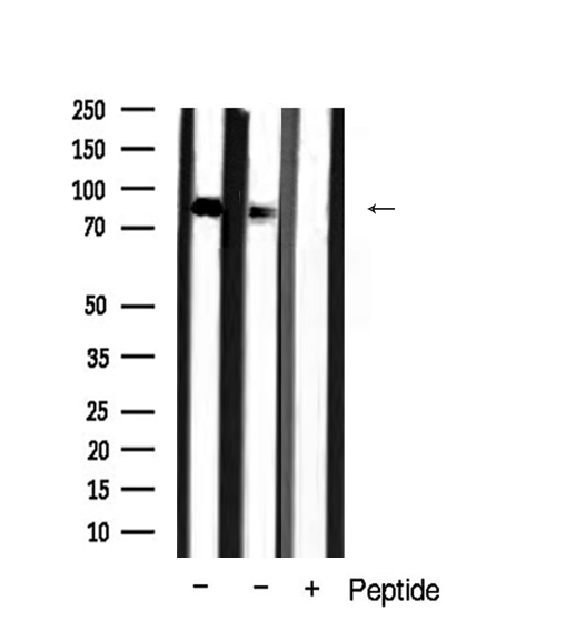 JUP/CTNNG/Junction Plakoglobin Antibody - Western blot analysis of Catenin-gamma expression in mouse tissue extract
