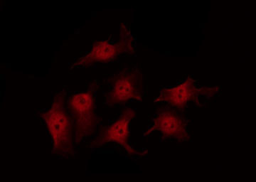 JUP/CTNNG/Junction Plakoglobin Antibody - Staining HeLa cells by IF/ICC. The samples were fixed with PFA and permeabilized in 0.1% Triton X-100, then blocked in 10% serum for 45 min at 25°C. The primary antibody was diluted at 1:200 and incubated with the sample for 1 hour at 37°C. An Alexa Fluor 594 conjugated goat anti-rabbit IgG (H+L) Ab, diluted at 1/600, was used as the secondary antibody.