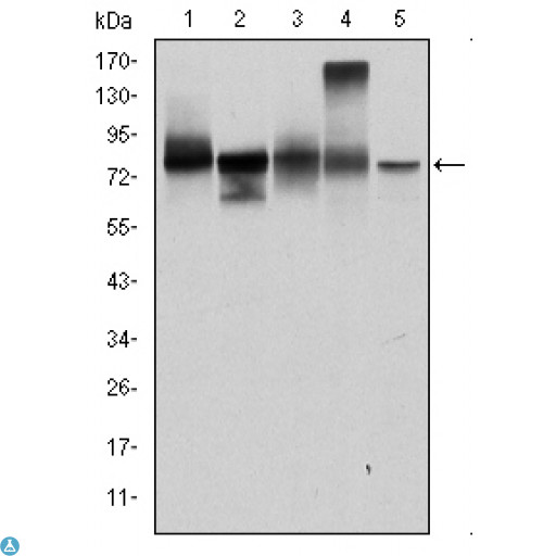 JUP/CTNNG/Junction Plakoglobin Antibody - ELISA analysis of Catenin-gamma antibody.