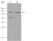 K13 / KCNG Antibody - Anti-KCNG1 rabbit polyclonal antibody at 1:500 dilution. Lane A: MCF7 Whole Cell Lysate. Lane B: HepG2 Whole Cell Lysate. Lysates/proteins at 30 ug per lane. Secondary: Goat Anti-Rabbit IgG (H+L)/HRP at 1/10000 dilution. Developed using the ECL technique. Performed under reducing conditions. Predicted band size: 58 kDa. Observed band size: 60 kDa.