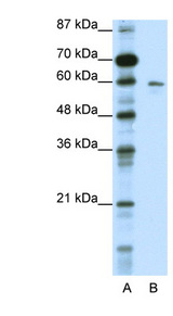 K13 / KCNG Antibody - KCNG1 / Kv6.1 antibody Western blot of HepG2 cell lysate. This image was taken for the unconjugated form of this product. Other forms have not been tested.