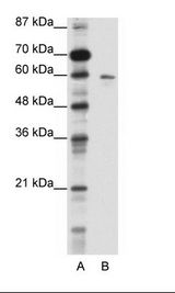 K13 / KCNG Antibody - A: Marker, B: HepG2 Cell Lysate.  This image was taken for the unconjugated form of this product. Other forms have not been tested.