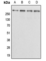 KALRN / KALIRIN Antibody - Western blot analysis of Kalirin expression in HEK293T (A); NIH3T3 (B); H9C2 (C); mouse brain (D) whole cell lysates.