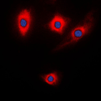 KALRN / KALIRIN Antibody - Immunofluorescent analysis of Kalirin staining in NIH3T3 cells. Formalin-fixed cells were permeabilized with 0.1% Triton X-100 in TBS for 5-10 minutes and blocked with 3% BSA-PBS for 30 minutes at room temperature. Cells were probed with the primary antibody in 3% BSA-PBS and incubated overnight at 4 C in a humidified chamber. Cells were washed with PBST and incubated with a DyLight 594-conjugated secondary antibody (red) in PBS at room temperature in the dark. DAPI was used to stain the cell nuclei (blue).