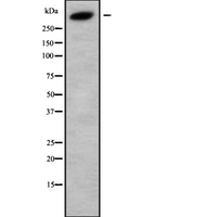 KALRN / KALIRIN Antibody - Western blot analysis of DUET using HuvEc whole cells lysates