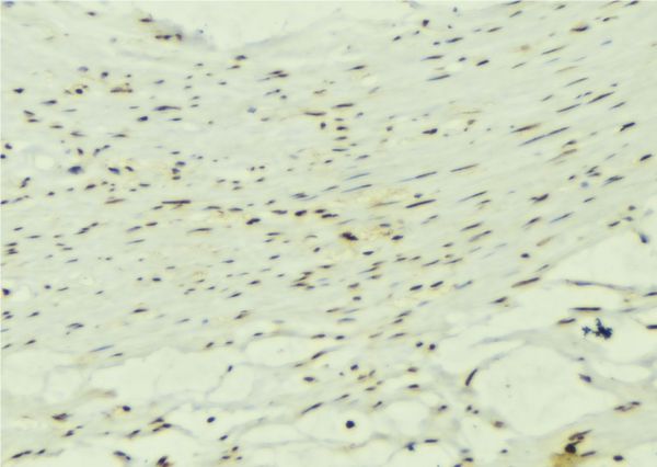 KALRN / KALIRIN Antibody - 1:100 staining mouse muscle tissue by IHC-P. The sample was formaldehyde fixed and a heat mediated antigen retrieval step in citrate buffer was performed. The sample was then blocked and incubated with the antibody for 1.5 hours at 22°C. An HRP conjugated goat anti-rabbit antibody was used as the secondary.
