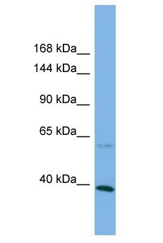 KANK1 Antibody - KANK1 antibody Western Blot of HCT15. Antibody dilution: 1 ug/ml.  This image was taken for the unconjugated form of this product. Other forms have not been tested.