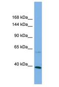 KANK1 Antibody - KANK1 antibody Western Blot of HCT15. Antibody dilution: 1 ug/ml.  This image was taken for the unconjugated form of this product. Other forms have not been tested.