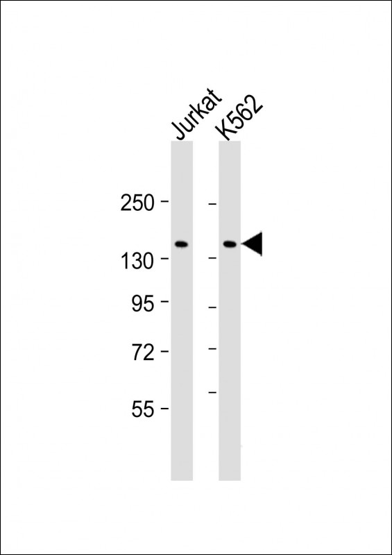KANK1 Antibody - All lanes: Anti-KANK1 Antibody at 1:2000 dilution Lane 1: Jurkat whole cell lysate Lane 2: K562 whole cell lysate Lysates/proteins at 20 µg per lane. Secondary Goat Anti-mouse IgG, (H+L), Peroxidase conjugated at 1/10000 dilution. Predicted band size: 147 kDa Blocking/Dilution buffer: 5% NFDM/TBST.
