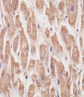 KANK1 Antibody - KANK1 Antibody staining KANK1 in human heart tissue sections by Immunohistochemistry (IHC-P - paraformaldehyde-fixed, paraffin-embedded sections). Tissue was fixed with formaldehyde and blocked with 3% BSA for 0. 5 hour at room temperature; antigen retrieval was by heat mediation with a citrate buffer (pH6). Samples were incubated with primary antibody (1/25) for 1 hours at 37°C. A undiluted biotinylated goat polyvalent antibody was used as the secondary antibody.