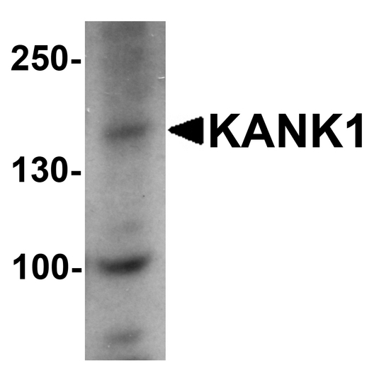 KANK1 Antibody - Western blot analysis of KANK1 in 3T3 cell lysate with KANK1 antibody at 1 ug/ml.