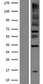 KANK1 Protein - Western validation with an anti-DDK antibody * L: Control HEK293 lysate R: Over-expression lysate