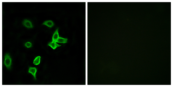 KANK2 Antibody - Immunofluorescence analysis of A549 cells, using KANK2 Antibody. The picture on the right is blocked with the synthesized peptide.