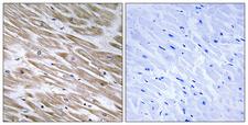 KANK2 Antibody - Immunohistochemistry analysis of paraffin-embedded human heart tissue, using KANK2 Antibody. The picture on the right is blocked with the synthesized peptide.