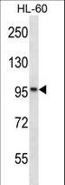 KANK2 Antibody - KANK2 Antibody western blot of HL-60 cell line lysates (35 ug/lane). The KANK2 antibody detected the KANK2 protein (arrow).