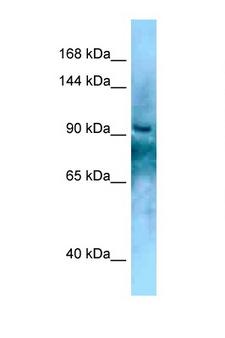 KANK2 Antibody - KANK2 antibody Western blot of Fetal Liver lysate. Antibody concentration 1 ug/ml.  This image was taken for the unconjugated form of this product. Other forms have not been tested.