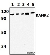 KANK2 Antibody - Western blot of KANK2 antibody at 1:1000 dilution. Lane 1: HELA whole cell lysate (51.3ug). Lane 2: The Uterus tissue lysate of Rat (43.4ug). Lane 3: The Uterus tissue lysate of Mouse (37.4ug). Lane 4: The Heart tissue lysate of Rat (43.4ug). Lane 5: The Heart.