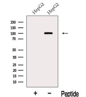 KANK2 Antibody - Western blot analysis of extracts of HepG2 cells using KANK2 antibody. The lane on the left was treated with blocking peptide.