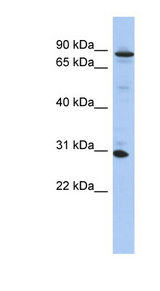 KANK3 Antibody - KANK3 / ANKRD47 antibody Western blot of 293T cell lysate. This image was taken for the unconjugated form of this product. Other forms have not been tested.