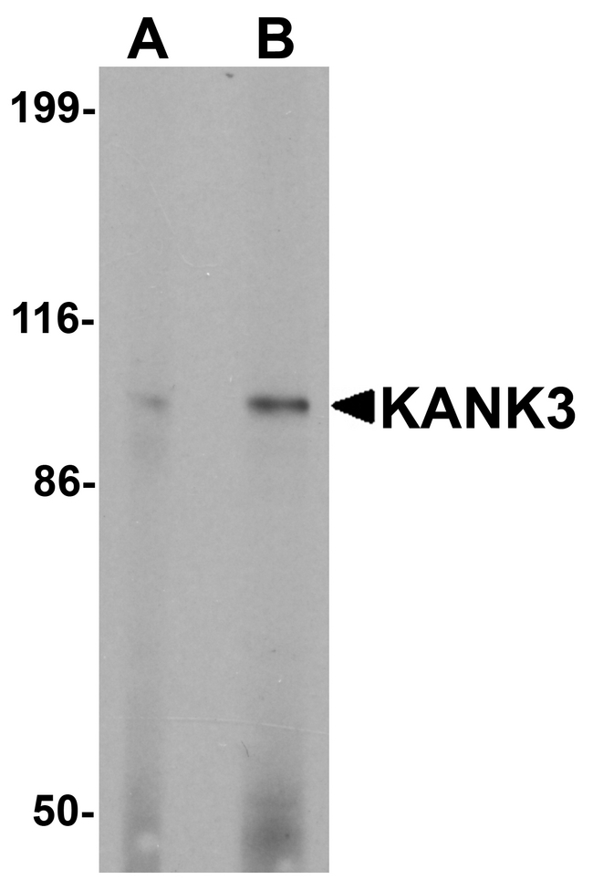 KANK3 Antibody - Western blot analysis of KANK3 in A431 cell lysate with KANK3 antibody at (A) 1 and (B) 2 ug/ml.