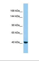 KANK4 Antibody - Western blot of Human HepG2. KANK4 antibody dilution 1.0 ug/ml.  This image was taken for the unconjugated form of this product. Other forms have not been tested.