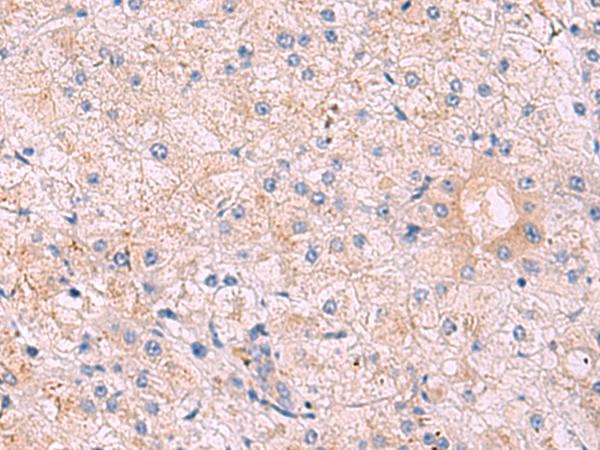 KANSL1L Antibody - Immunohistochemistry of paraffin-embedded Human tonsil tissue  using KANSL1L Polyclonal Antibody at dilution of 1:40(×200)