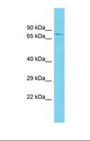 KANSL2 / C12orf41 Antibody - Western blot of Human Placenta. KANSL2 antibody dilution 1.0 ug/ml.  This image was taken for the unconjugated form of this product. Other forms have not been tested.