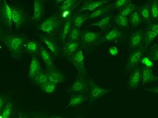 KANSL2 / C12orf41 Antibody - Immunofluorescence staining of KANSL2 in U2OS cells. Cells were fixed with 4% PFA, permeabilzed with 0.1% Triton X-100 in PBS, blocked with 10% serum, and incubated with rabbit anti-Human KANSL2 polyclonal antibody (dilution ratio 1:200) at 4°C overnight. Then cells were stained with the Alexa Fluor 488-conjugated Goat Anti-rabbit IgG secondary antibody (green). Positive staining was localized to Nucleus and cytoplasm.