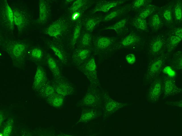 KANSL2 / C12orf41 Antibody - Immunofluorescence staining of KANSL2 in U2OS cells. Cells were fixed with 4% PFA, permeabilzed with 0.1% Triton X-100 in PBS, blocked with 10% serum, and incubated with rabbit anti-Human KANSL2 polyclonal antibody (dilution ratio 1:200) at 4°C overnight. Then cells were stained with the Alexa Fluor 488-conjugated Goat Anti-rabbit IgG secondary antibody (green). Positive staining was localized to Nucleus and cytoplasm.