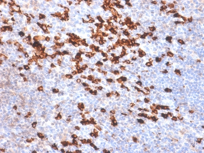 Kappa Light Chain Antibody - Formalin-fixed, paraffin-embedded human Tonsil stained with Kappa Lt. Chain Rabbit Recombinant Monoclonal Antibody (IGKC /1999R).