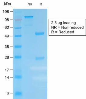 Kappa Light Chain Antibody - SDS-PAGE Analysis Purified Kappa Lt. Chain Rabbit Recombinant Monoclonal (IGKC /1999R). Confirmation of Purity and Integrity of Antibody.