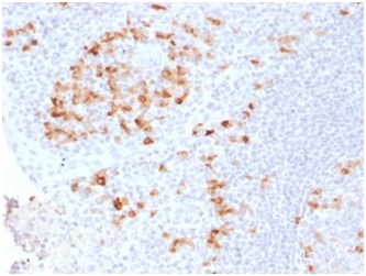 Kappa Light Chain Antibody - Formalin-fixed, paraffin-embedded Human Tonsil stained with Kappa Light Chain Rabbit Recombinant Monoclonal (KLC2289R).