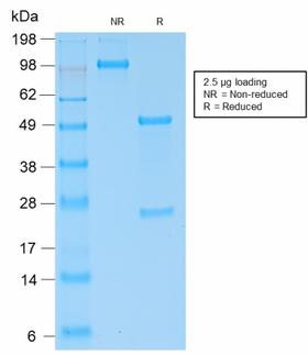 Kappa Light Chain Antibody - SDS-PAGE Analysis of Purified Kappa Light Chain Rabbit Recombinant Monoclonal (KLC2289R). Confirmation of Purity and Integrity of Antibody.