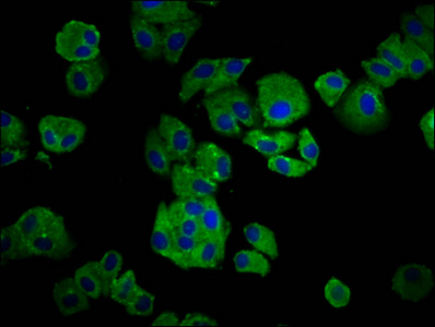 Kappa Light Chain Antibody - Immunofluorescence staining of HepG2 cells diluted at 1:66, counter-stained with DAPI. The cells were fixed in 4% formaldehyde, permeabilized using 0.2% Triton X-100 and blocked in 10% normal Goat Serum. The cells were then incubated with the antibody overnight at 4°C.The Secondary antibody was Alexa Fluor 488-congugated AffiniPure Goat Anti-Rabbit IgG (H+L).