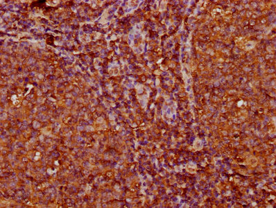 Kappa Light Chain Antibody - Immunohistochemistry Dilution at 1:200 and staining in paraffin-embedded human tonsil tissue performed on a Leica BondTM system. After dewaxing and hydration, antigen retrieval was mediated by high pressure in a citrate buffer (pH 6.0). Section was blocked with 10% normal Goat serum 30min at RT. Then primary antibody (1% BSA) was incubated at 4°C overnight. The primary is detected by a biotinylated Secondary antibody and visualized using an HRP conjugated SP system.