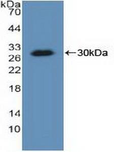 KARS Antibody - Western Blot; Sample: Recombinant KARS, Human.