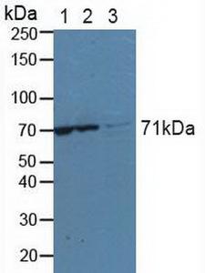 KARS Antibody - Western Blot; Sample: Lane1: Human Jurkat Cells; Lane2: Human Hela Cells; Lane3: Human A549 Cells.