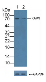 KARS Antibody - Knockout Varification: Lane 1: Wild-type Jurkat cell lysate; Lane 2: KARS knockout Jurkat cell lysate; Predicted MW: 68,71kd Observed MW: 71kd Primary Ab: 3µg/ml Rabbit Anti-Human KARS Antibody Second Ab: 0.2µg/mL HRP-Linked Caprine Anti-Rabbit IgG Polyclonal Antibody