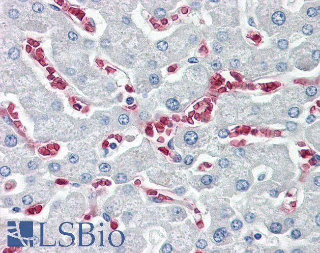 KARS Antibody - Anti-KARS antibody IHC of human liver. Immunohistochemistry of formalin-fixed, paraffin-embedded tissue after heat-induced antigen retrieval. Antibody dilution 5-10 ug/ml. This image was taken for the unconjugated form of this product. Other forms have not been tested.